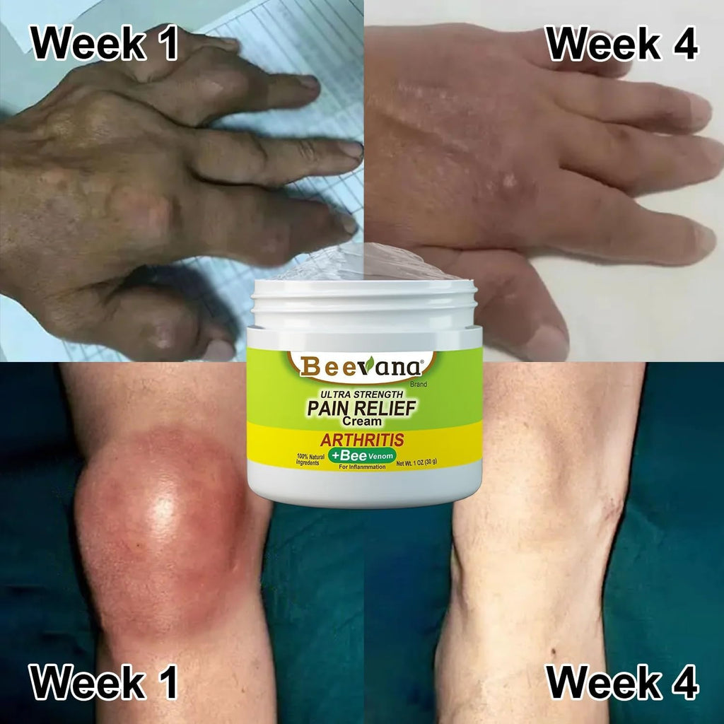 Combo Premium Zamia Power | Bee Venom + Beevana + Crema para Várices + Crema Aclarante Original