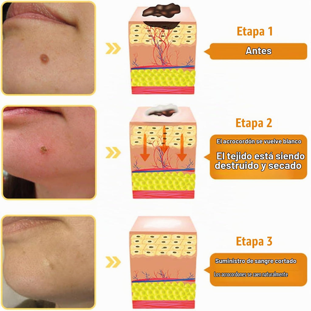 Bee Venom Crema de Veneno de Abeja | Cuidado y Apariencia Renovada de la Piel