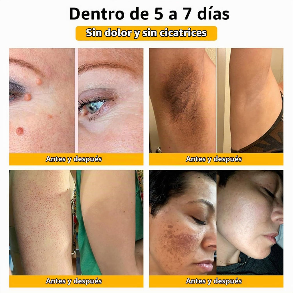 Bee Venom Crema de Veneno de Abeja | Cuidado y Apariencia Renovada de la Piel