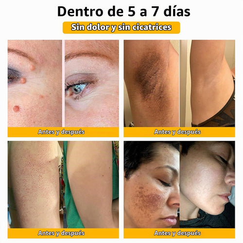 Bee Venom Crema de Veneno de Abeja | Cuidado y Apariencia Renovada de la Piel