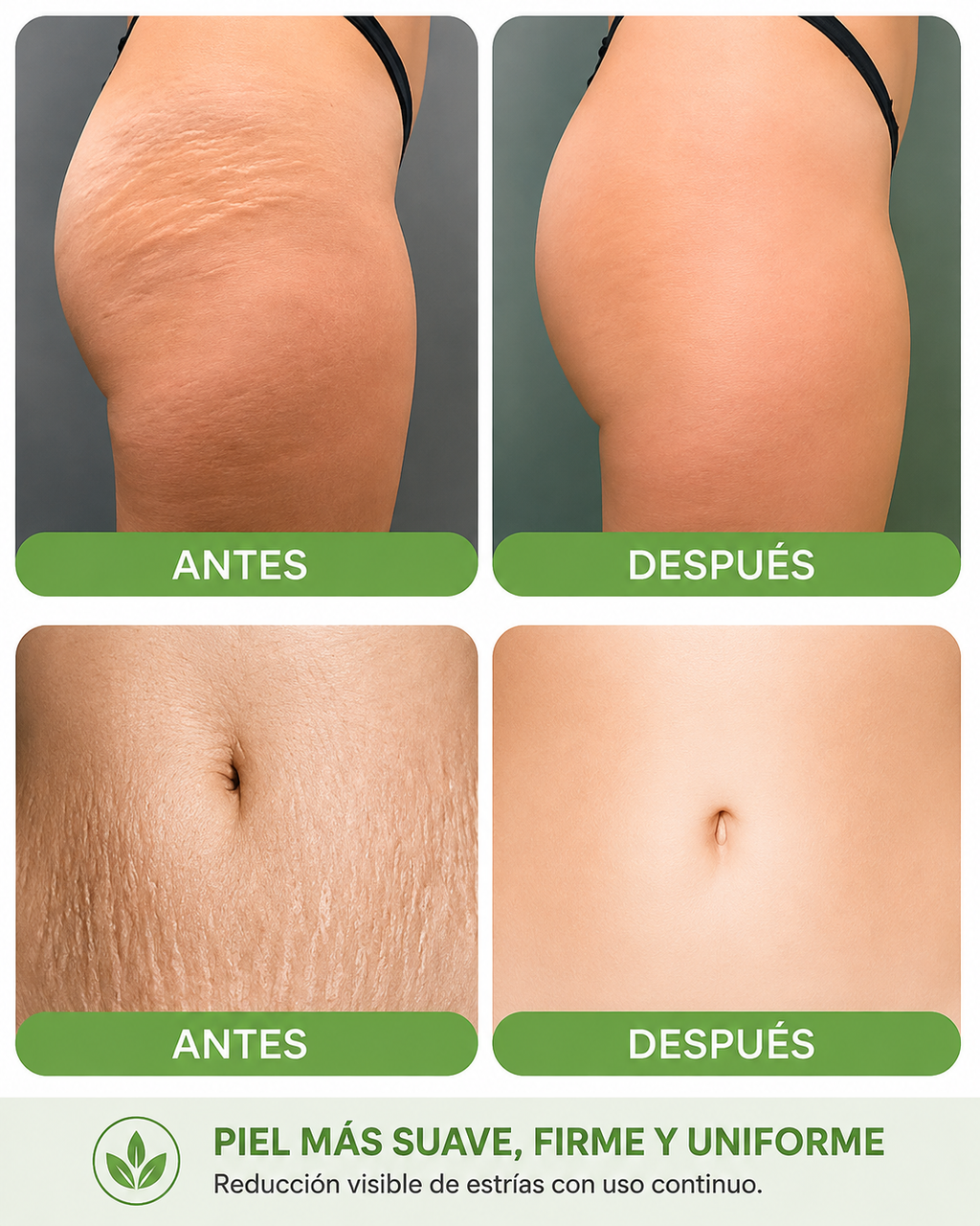 Crema Antiestrías SkinRepair 60 g | Cuidado, Hidratación y Apariencia de la Piel