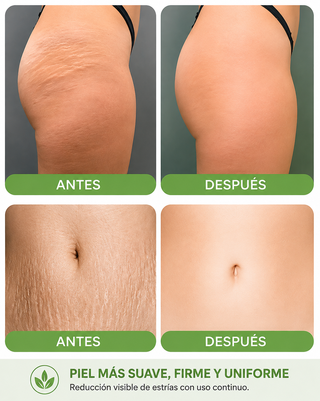 Crema Antiestrías SkinRepair 60 g | Cuidado, Hidratación y Apariencia de la Piel
