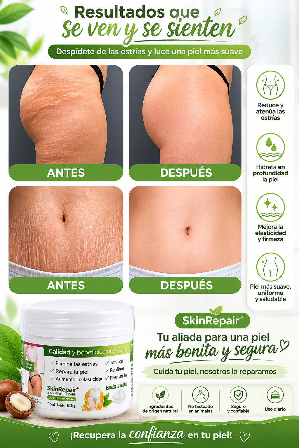 Crema Antiestrías SkinRepair 60 g | Cuidado, Hidratación y Apariencia de la Piel
