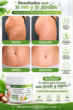 Crema Antiestrías SkinRepair 60 g | Cuidado, Hidratación y Apariencia de la Piel