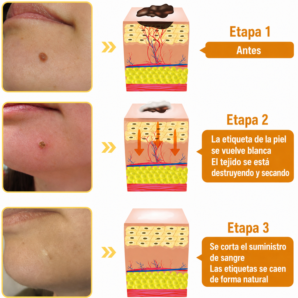 Combo Premium Zamia Power | Bee Venom + Beevana + Crema para Várices + Crema Aclarante Original