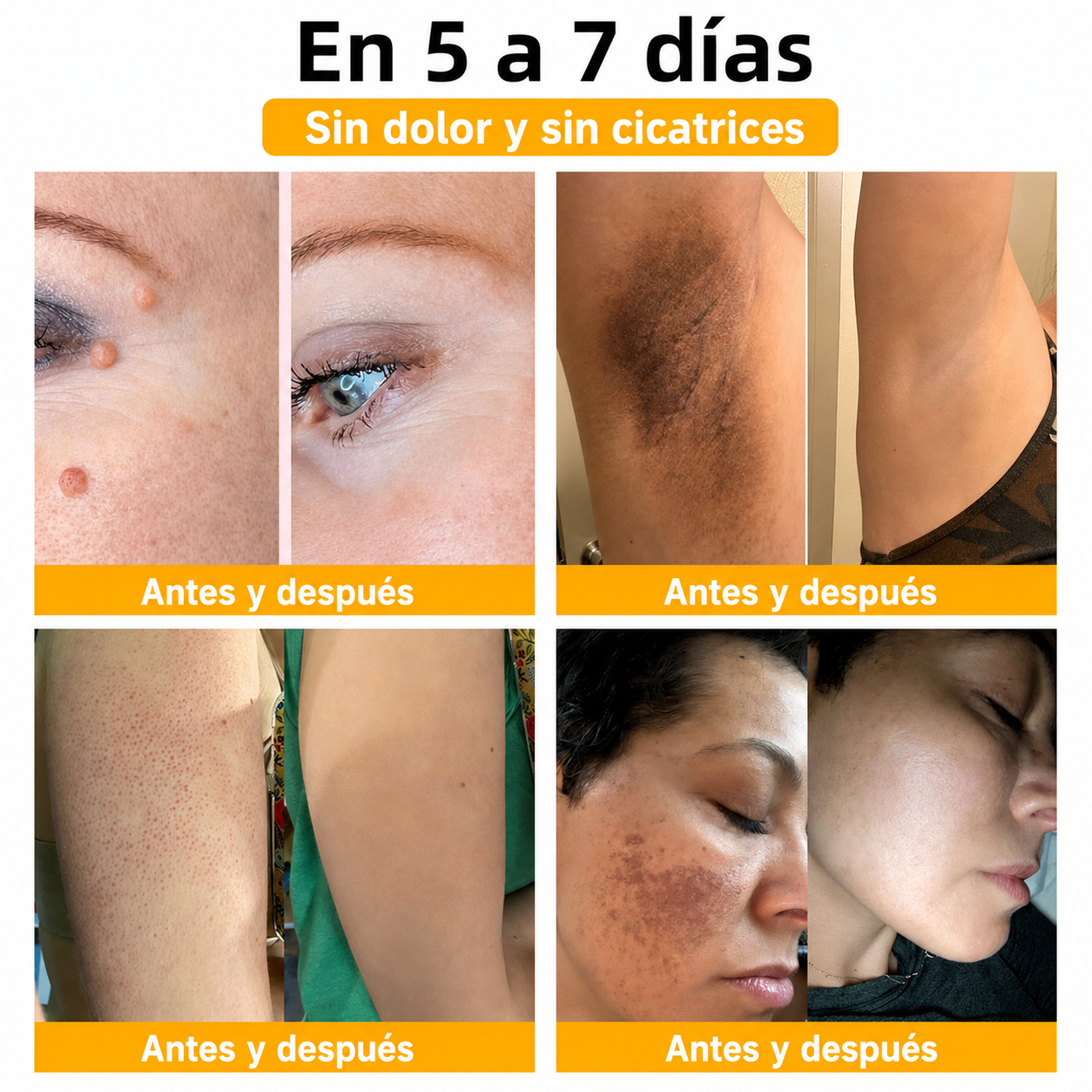 Combo Premium Zamia Power | Bee Venom + Beevana + Crema para Várices + Crema Aclarante Original